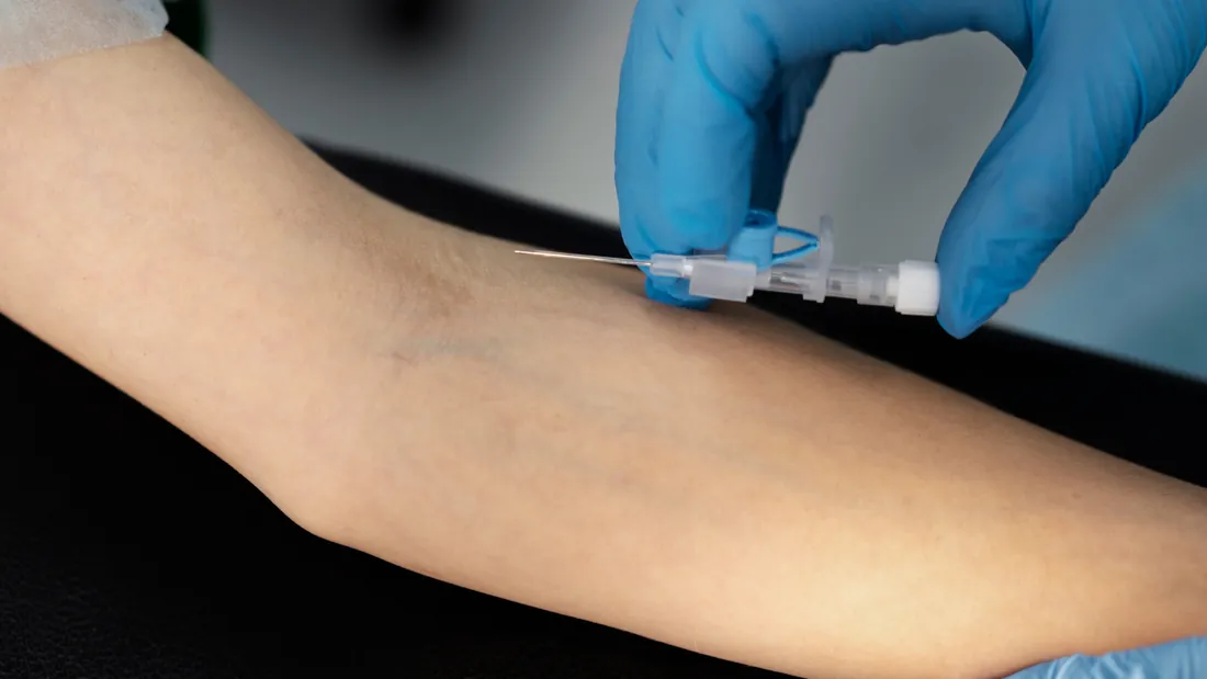 Angiografia por Cateter: 6 Indicações e Como o Exame Salva Vidas Vasculares