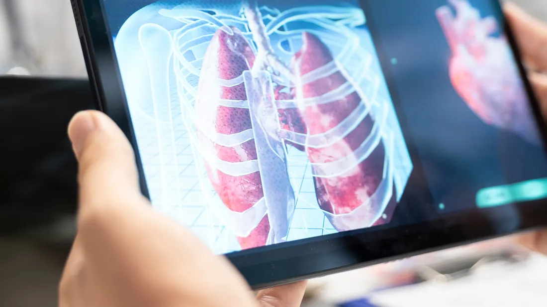 Angiotomografia Vascular: 6 Indicações e Como o Exame Orienta o Cirurgião Vascular