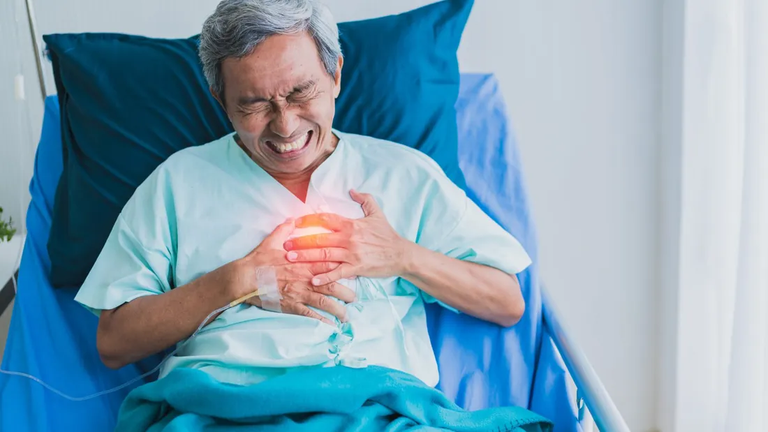 Aterosclerose: o que é, causas, sintomas e como prevenir