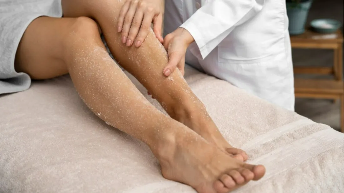 Espuma para varizes: como funciona o tratamento com escleroterapia guiada por ultrassom