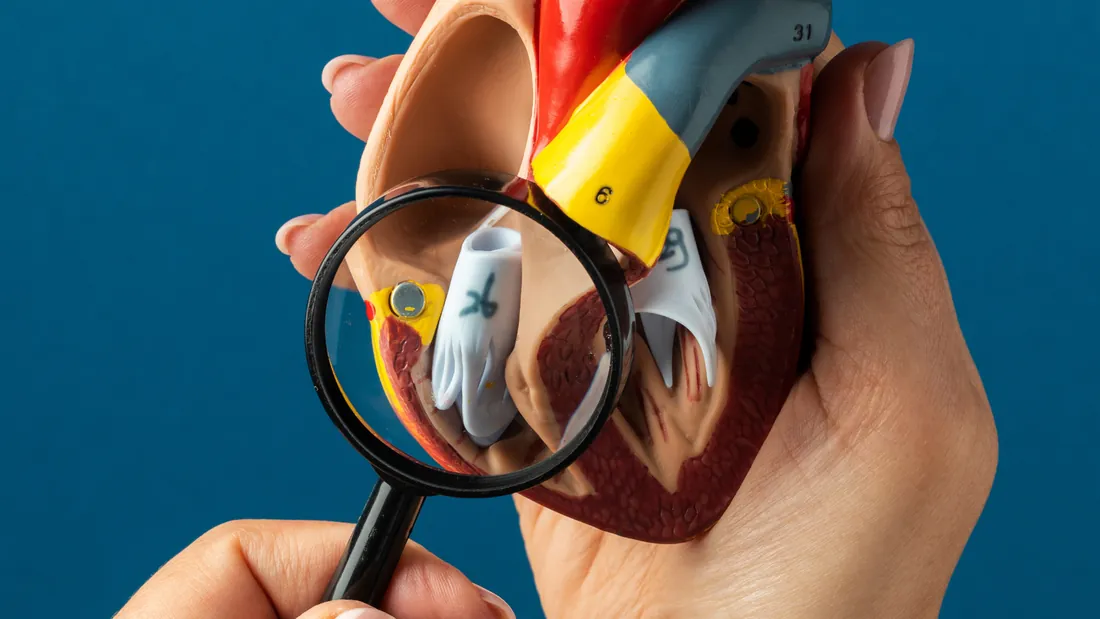Hipercolesterolemia Familiar: 5 Sinais, Diagnóstico e o Papel do Angiologista