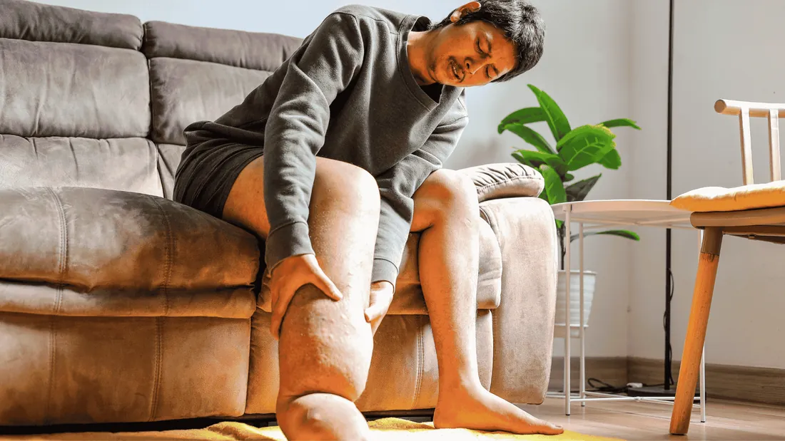 Linfedema: O Inchaço Crônico que Exige o Olhar do Cirurgião Vascular e Terapia Complexa