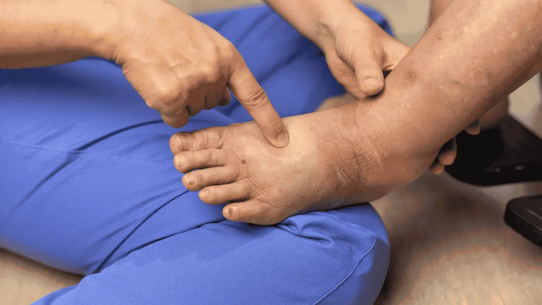 O Resgate do Pé Diabético: Prevenção, Diagnóstico de Isquemia e a Intervenção Vascular