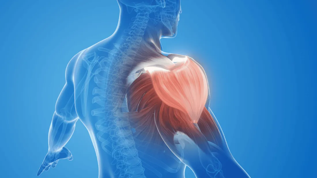 Síndrome do Desfiladeiro Torácico: Desvendando a Compressão Neurovascular no Ombro