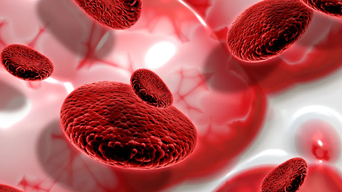 Trombofilia: 7 Causas, Diagnóstico e Como Prevenir a Trombose Hereditária